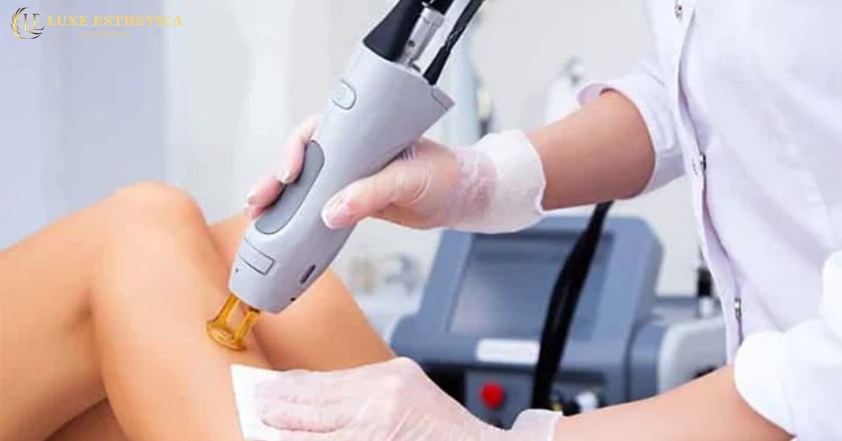 Benefits of Laser Hair Reduction for Men & Women