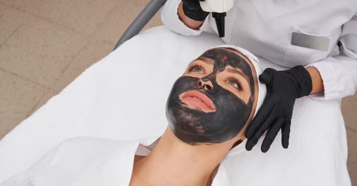 ​What is a Carbon Peel Facial