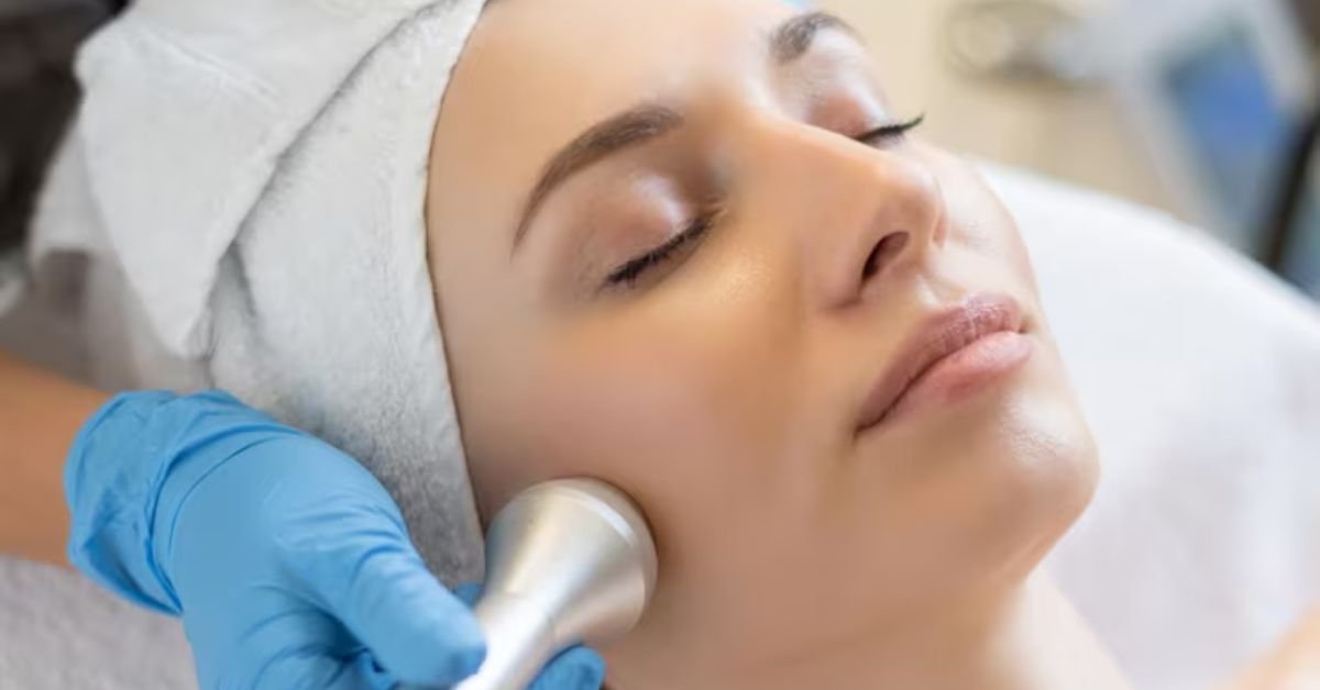 photo Facial benefits